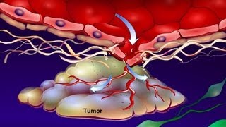 Hallmarks of Cancer  Pathophysiology [upl. by Anelle]