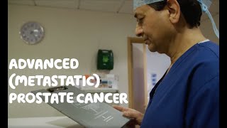 About Advanced Metastatic Prostate Cancer [upl. by Ammadas]