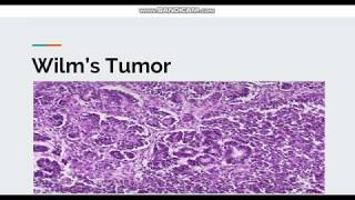 Wilms Tumor [upl. by Greerson167]